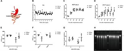 Single-Anastomosis Duodenal Jejunal Bypass Improve Glucose Metabolism by Regulating Gut Microbiota and Short-Chain Fatty Acids in Goto-Kakisaki Rats